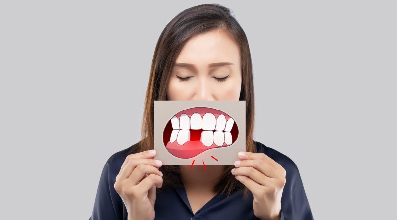 ฟันแตก-ฟันหัก จากการเกิดอุบัติเหตุ