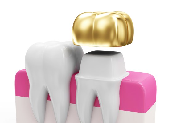 health-tooth-teeth-with-golden-dental-crown