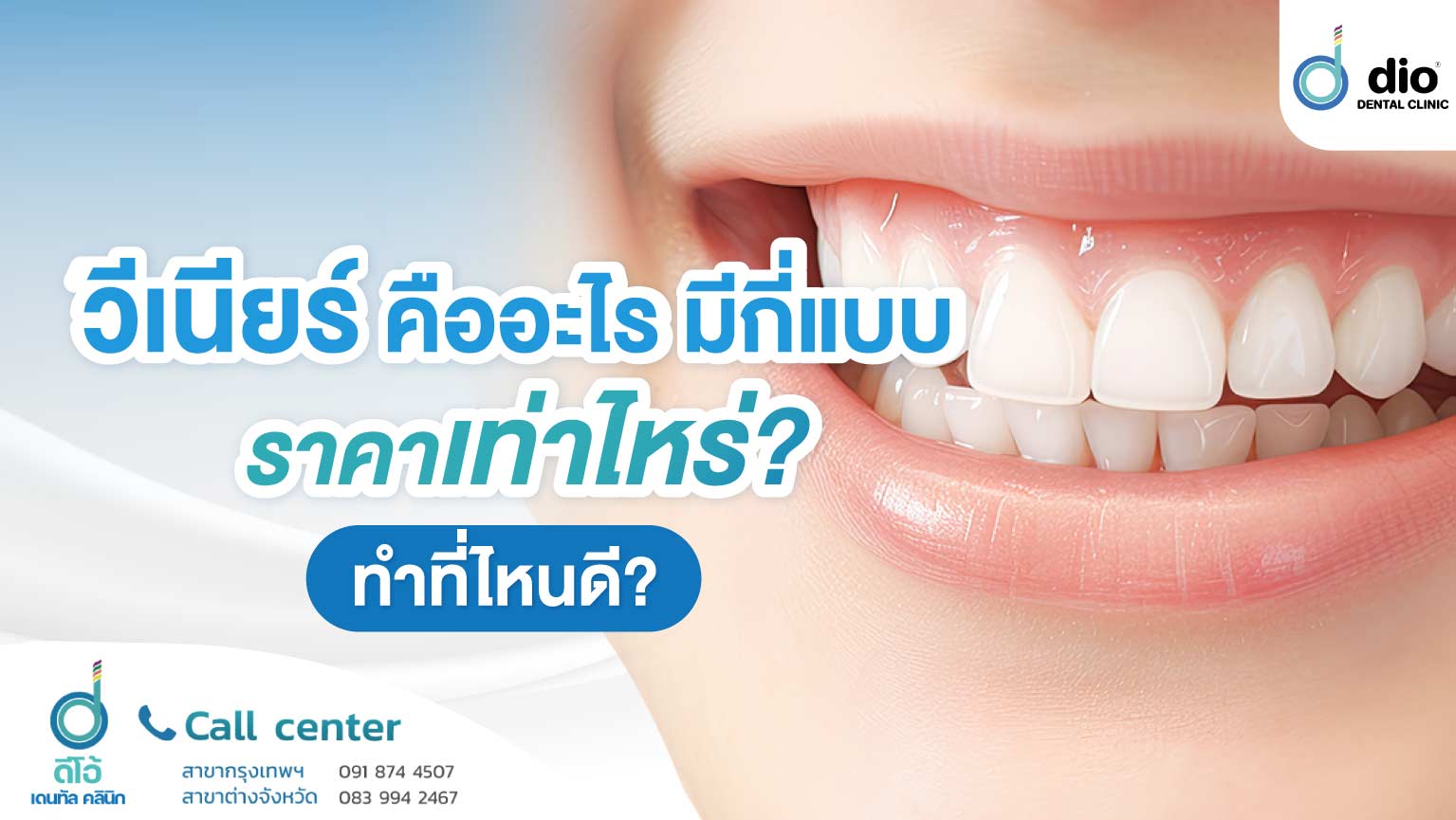 วีเนียร์ คือะไร