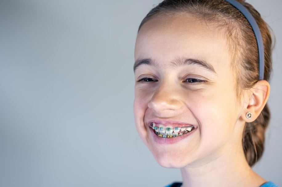 การจัดฟันในวัยเด็กมีความสำคัญ และมีข้อดีใดบ้าง