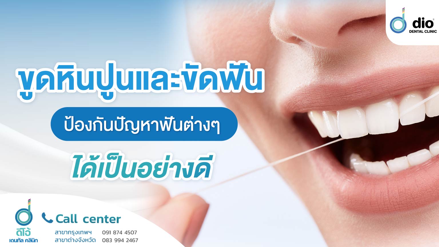 ขูดหินปูน และขัดฟันป้องกันปัญหาฟันต่างๆ-ได้เป็นอย่างดี