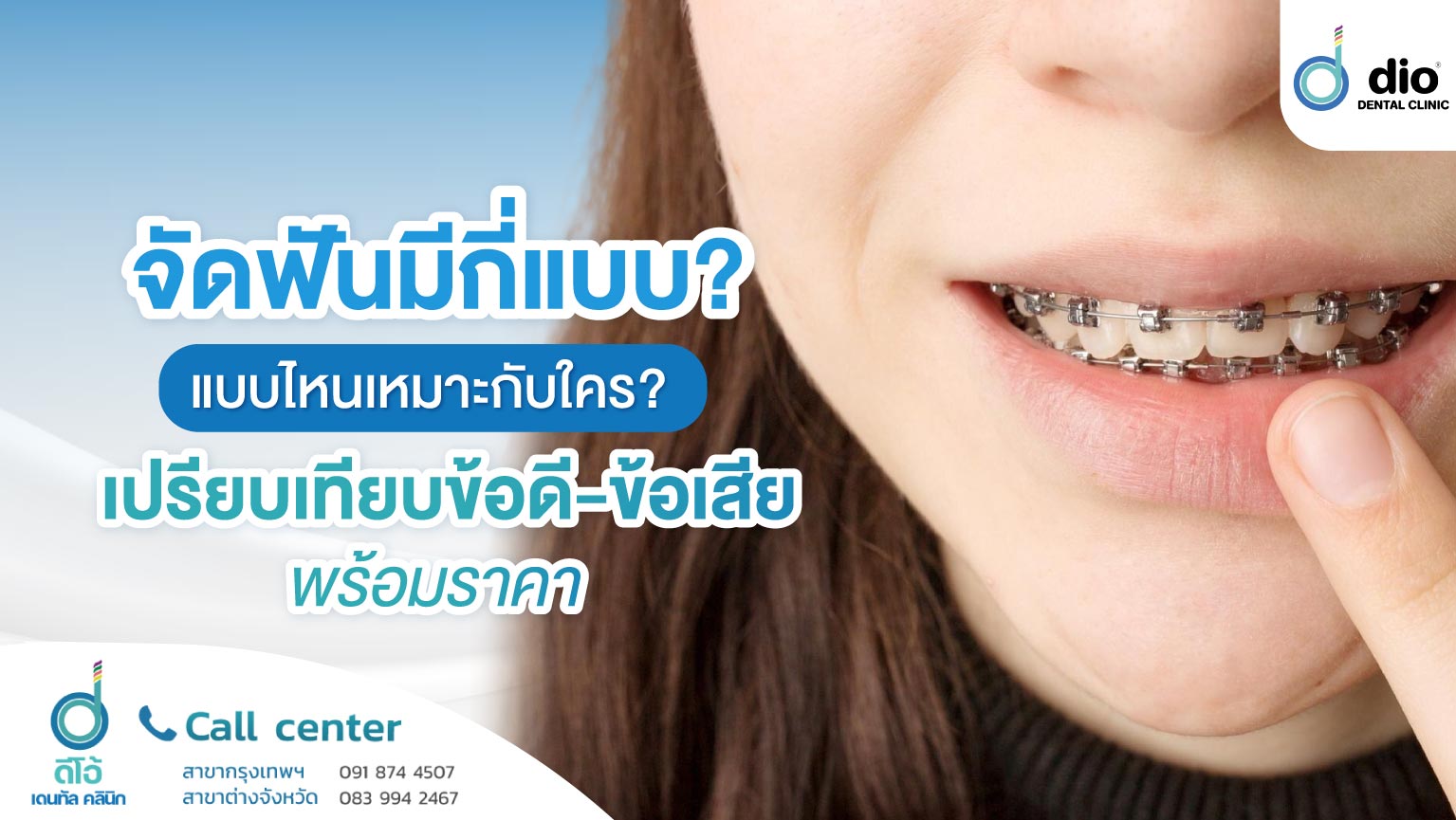 จัดฟันมีกี่แบบ แบบไหนเหมาะกับใคร เปรียบเทียบข้อดีข้อเสีย พร้อมราคา