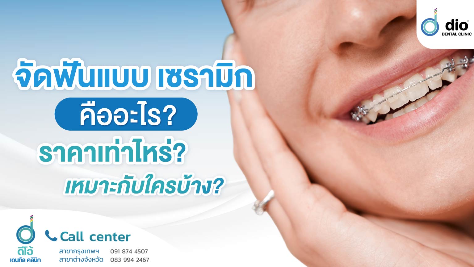 จัดฟันแบบเซรามิก-คืออะไร--ราคาเท่าไหร่--เหมาะกับใครบ้าง- (1)
