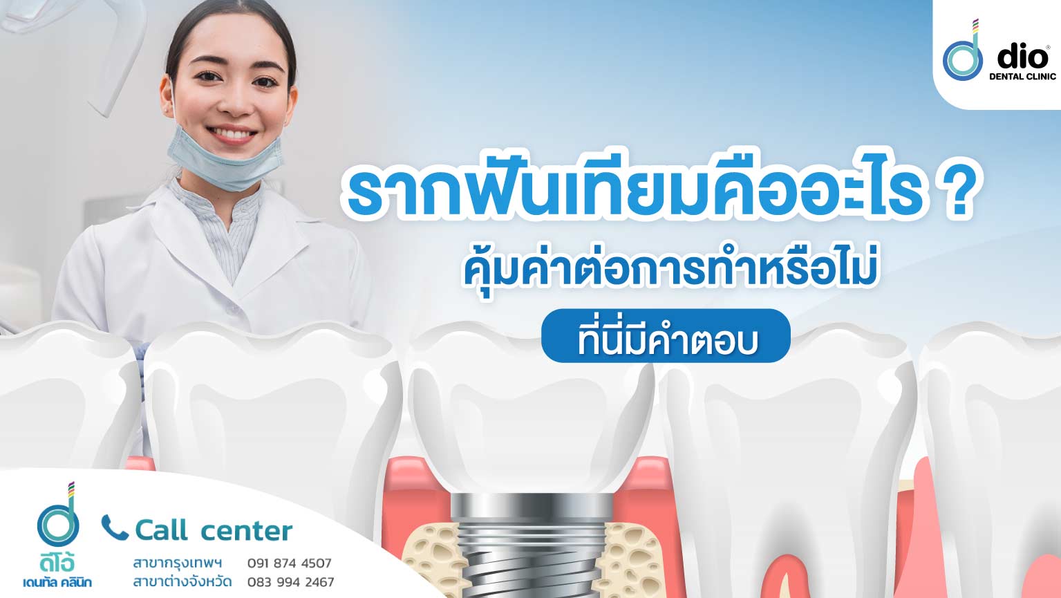 รากฟันเทียม คืออะไร คุ้มค่าต่อการทำหรือไม่ ที่นี่มีคำตอบ