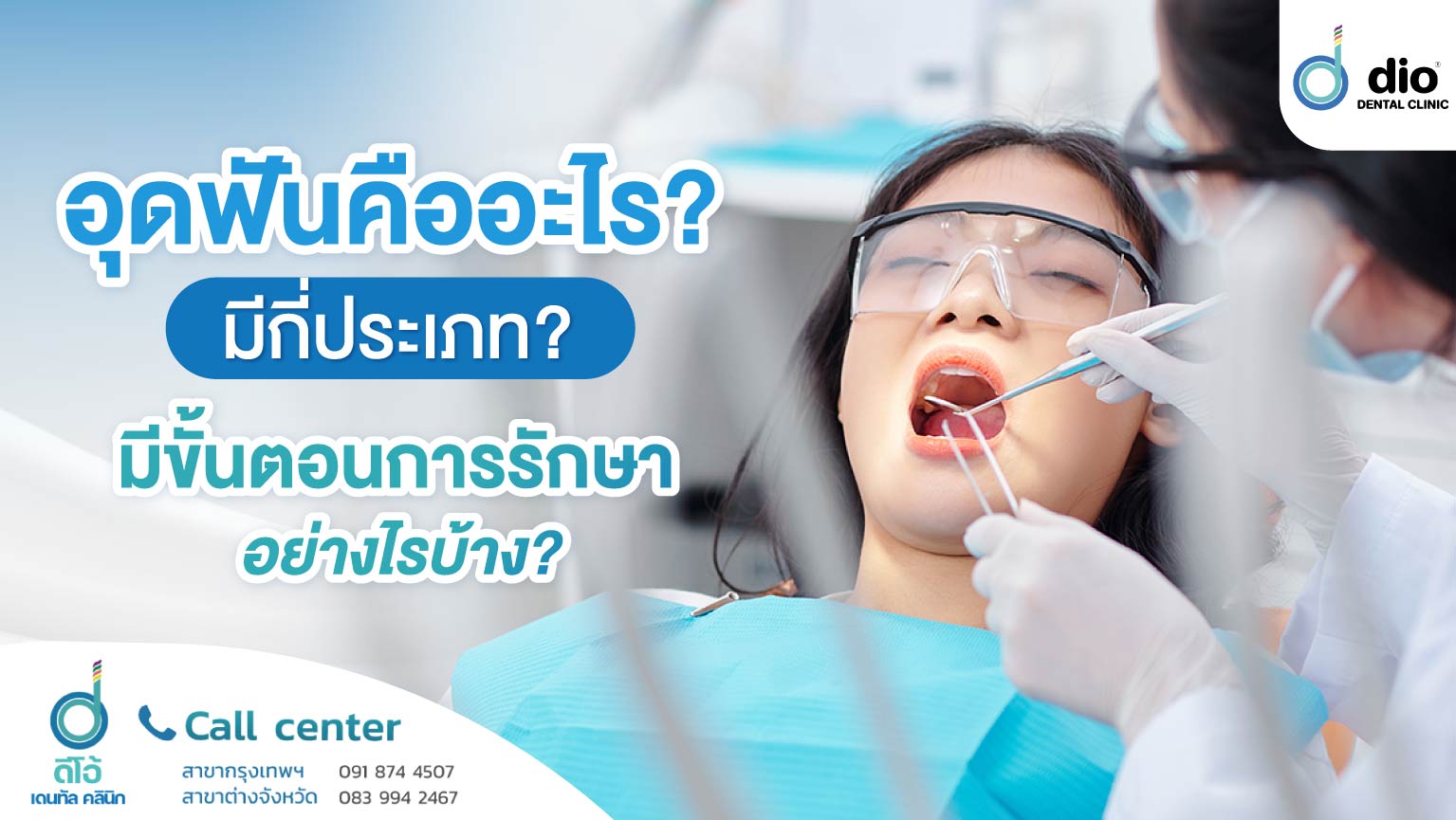 อุดฟัน คืออะไร-มีกี่ประเภท-มีขั้นตอนการรักษา-อย่างไรบ้าง