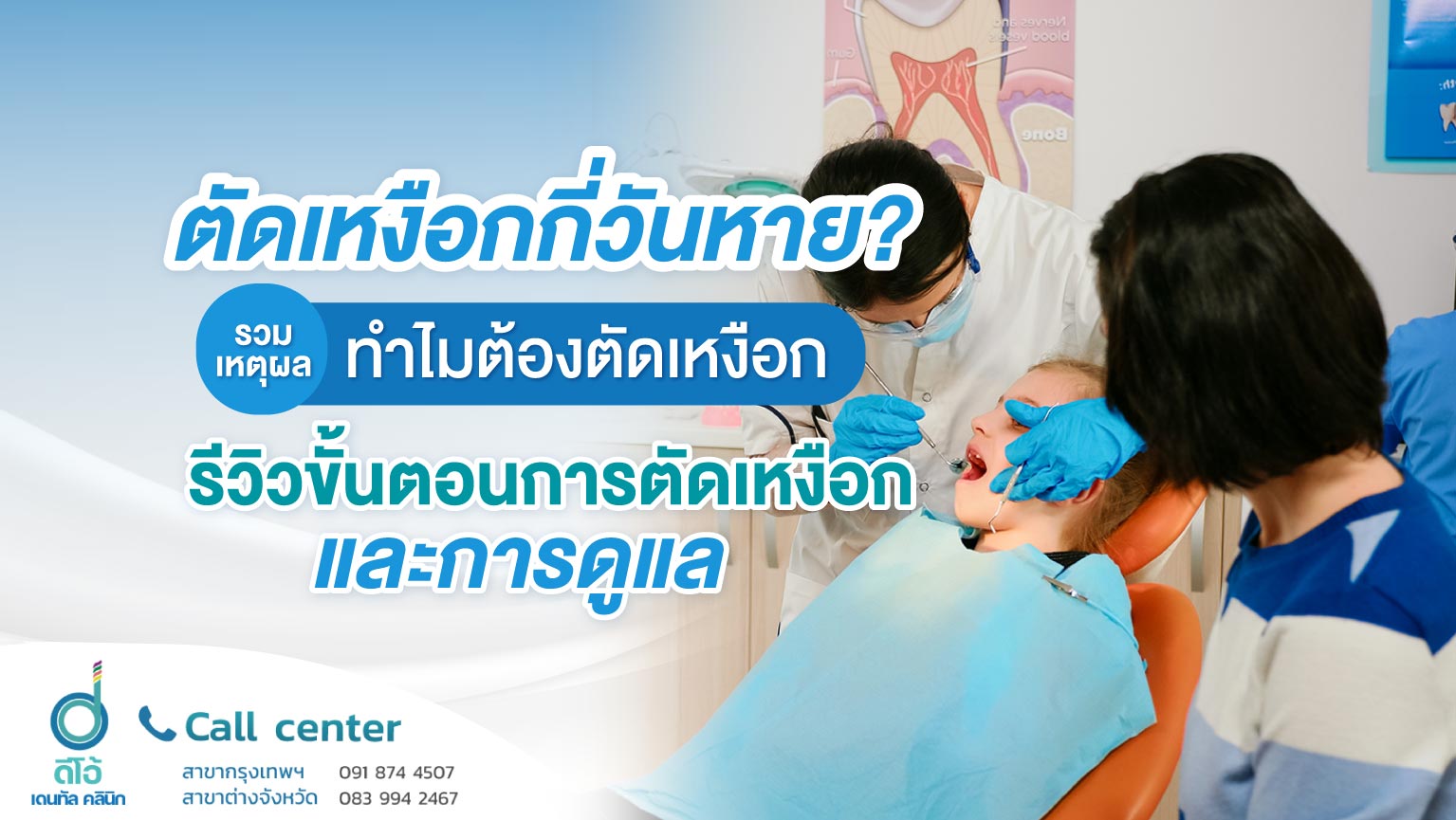 รวมเหตุผล ทำไมต้องศัลยกรรมเหงือก รีวิวขั้นตอนการศัลยกรรมเหงือ และการดูแล