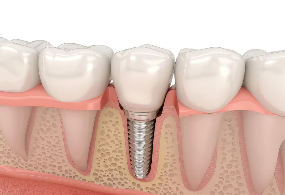 %E0%B8%A3%E0%B8%B1%E0%B8%81%E0%B8%A9%E0%