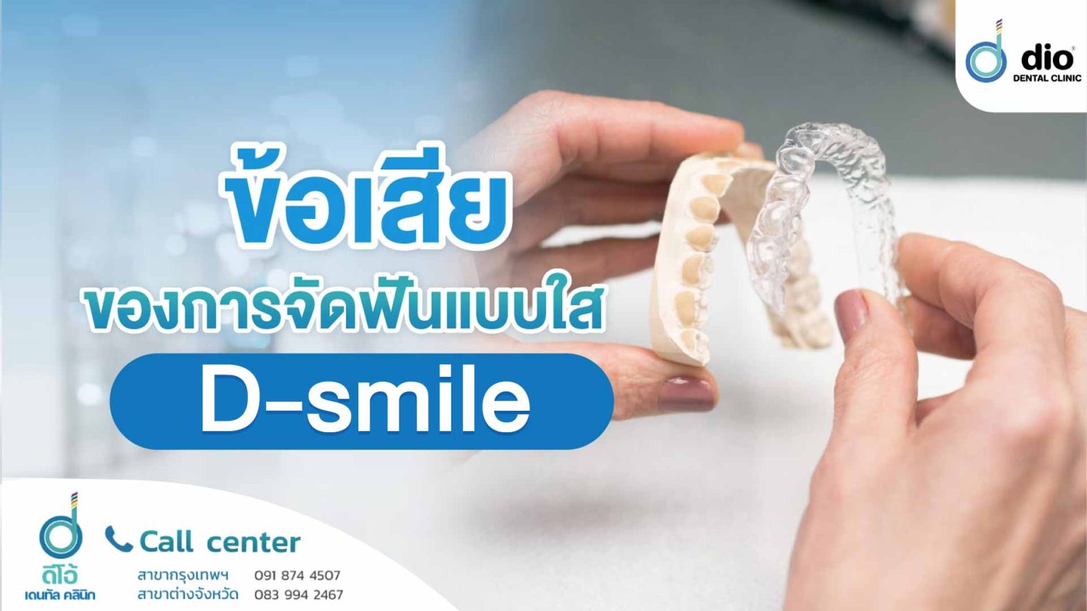 ข้อเสียของการจัดฟันแบบใส D-smile