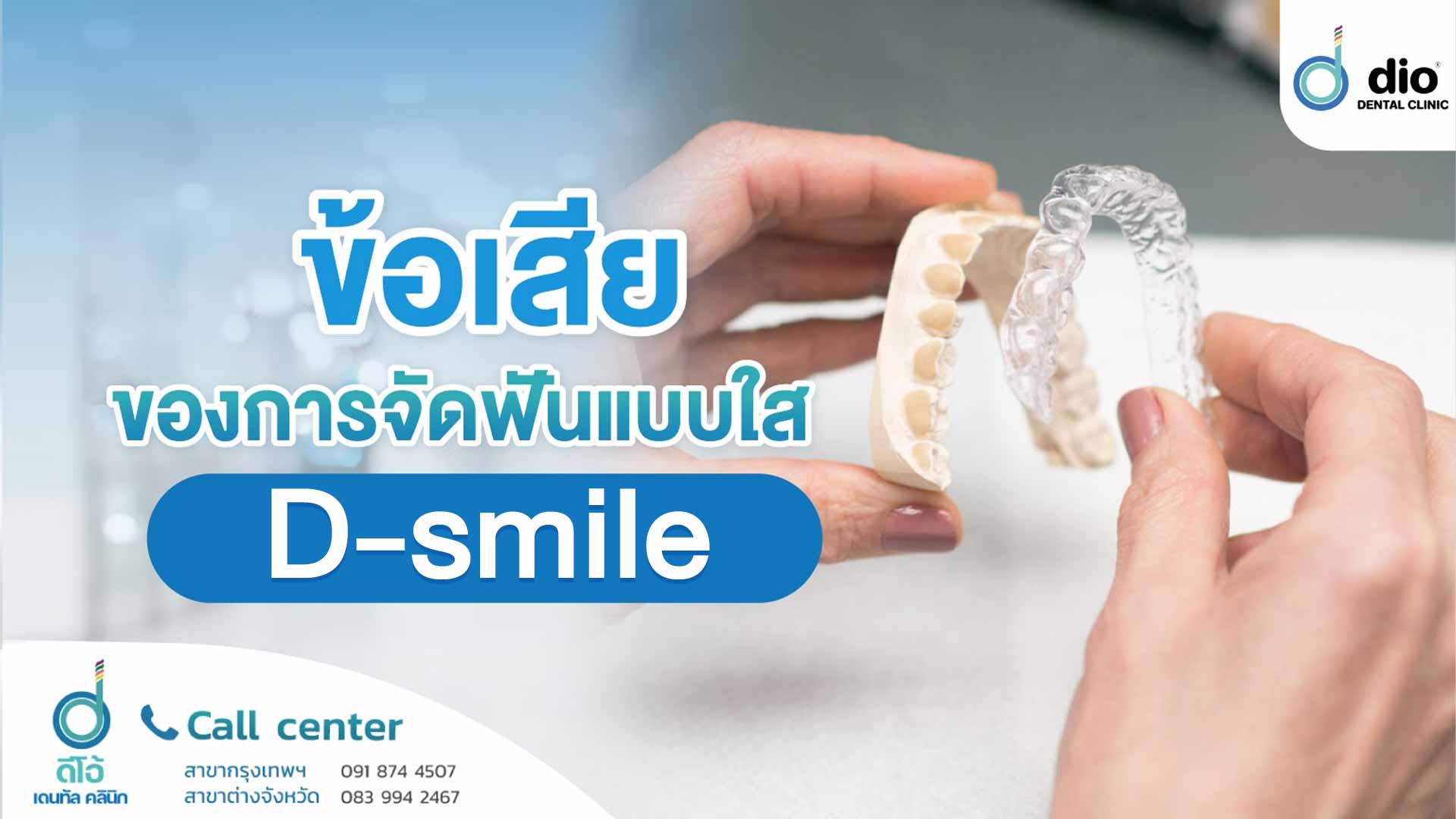 ข้อเสียของการจัดฟันแบบใส D-smile