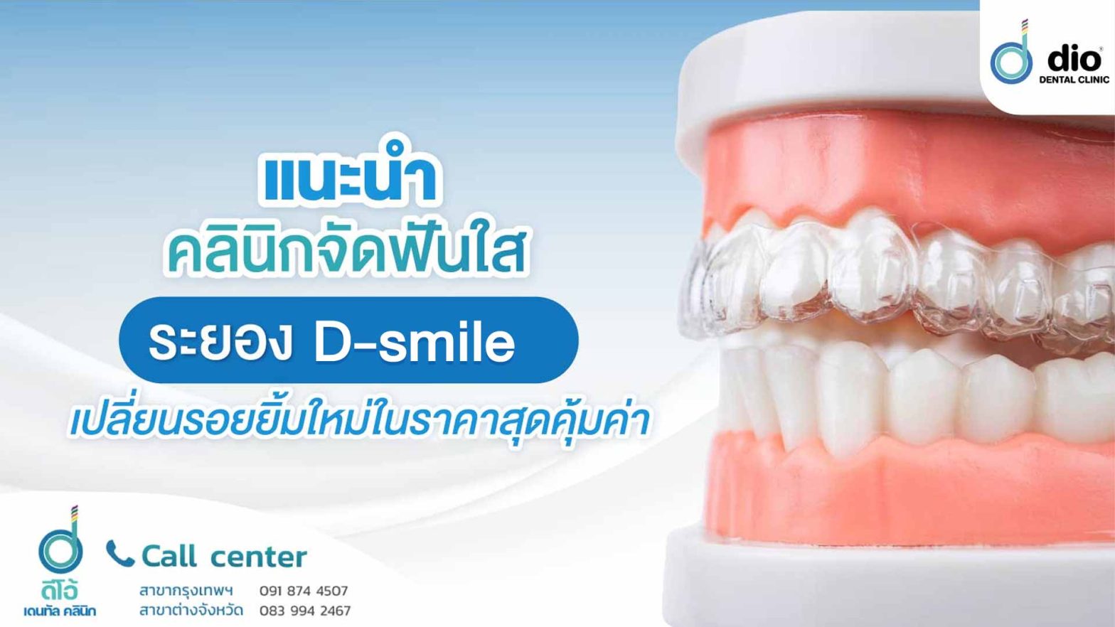 แนะนำคลินิกจัดฟันใส ระยอง D-smile เปลี่ยนรอยยิ้มใหม่ในราคาที่คุ้มค่า