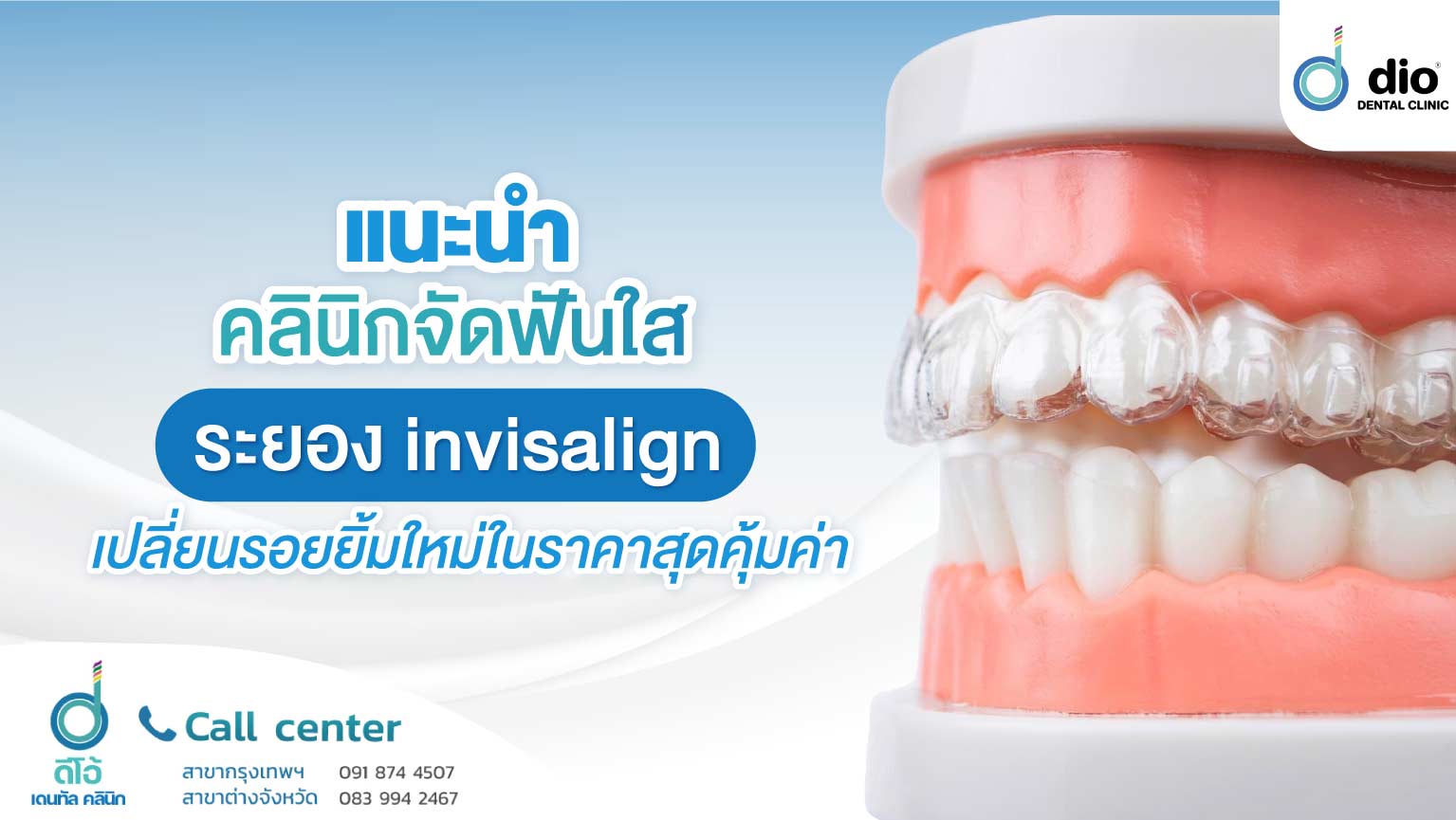 แนะนำคลินิกจัดฟันใส ระยอง invisalign เปลี่ยนรอยยิ้มใหม่ในราคาที่คุ้มค่า