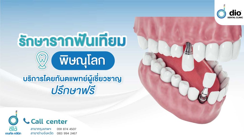 \u0e04\u0e25\u0e34\u0e19\u0e34\u0e01\u0e23\u0e31\u0e01\u0e29\u0e32\u0e23\u0e32\u0e01\u0e1f\u0e31\u0e19\u0e40\u0e17\u0e35\u0e22\u0e21 \u0e1e\u0e34\u0e29\u0e13\u0e38\u0e42\u0e25\u0e01 \u0e17\u0e33\u0e17\u0e35\u0e48\u0e44\u0e2b\u0e19\u0e14\u0e35?