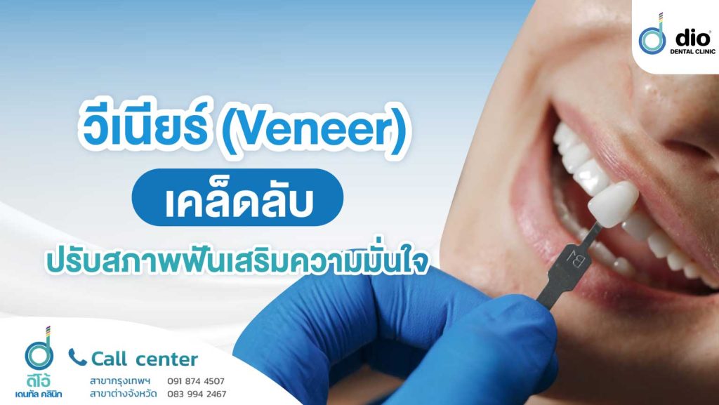 วีเนียร์