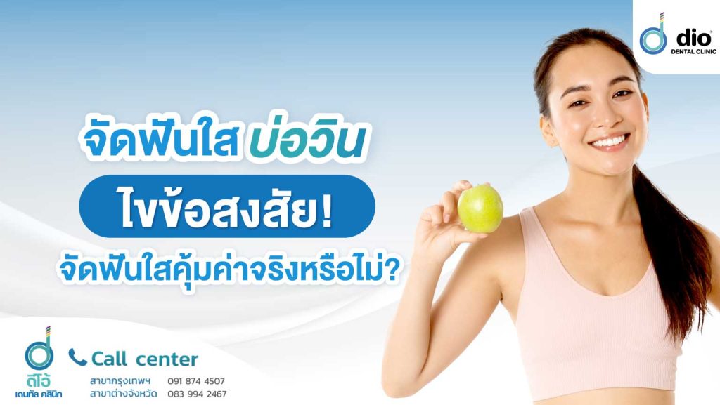 จัดฟันใส บ่อวิน