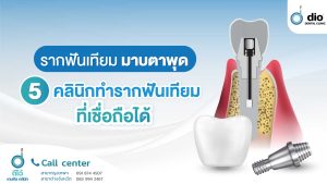 รากฟันเทียม มาบตาพุด