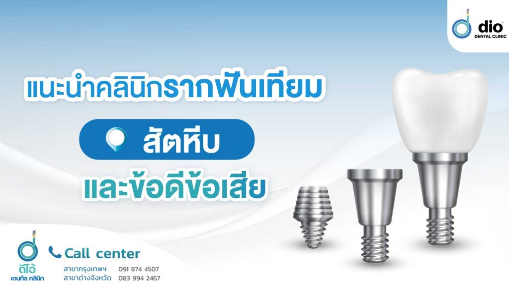 รากฟันเทียม สัตหีบ