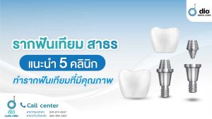 รากฟันเทียม สาธร