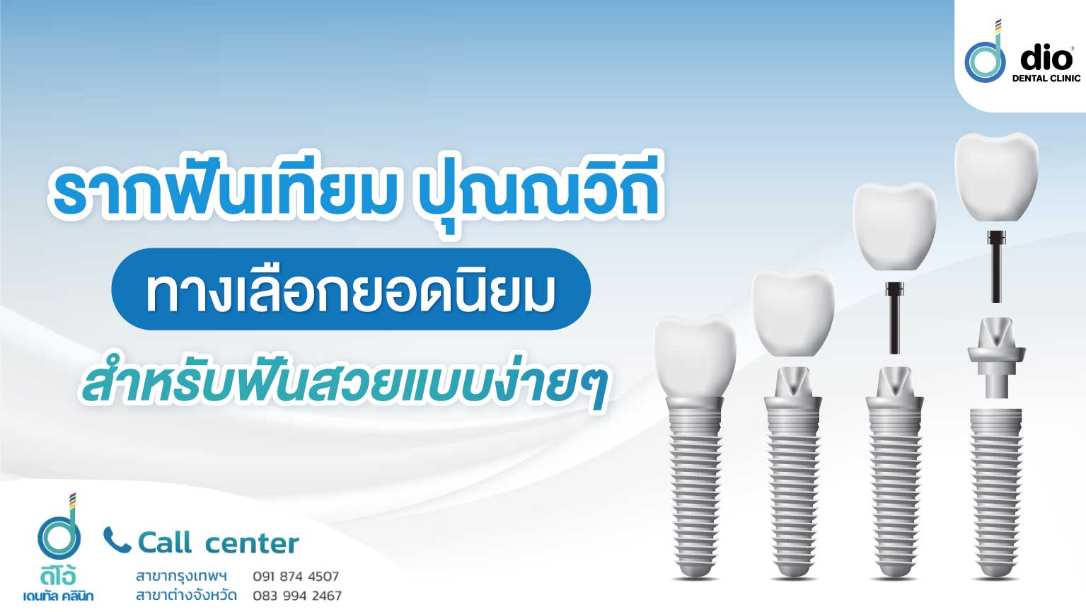 รากฟันเทียมปุณณวิถี