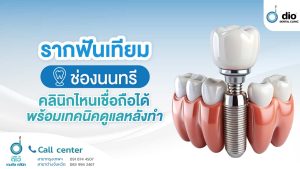 รากฟันเทียม ช่องนนทรี