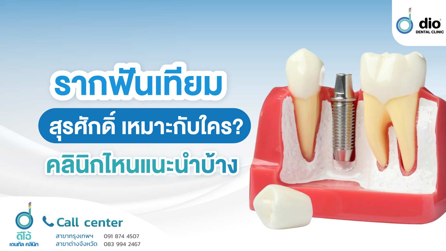 รากฟันเทียม สุรศักดิ์