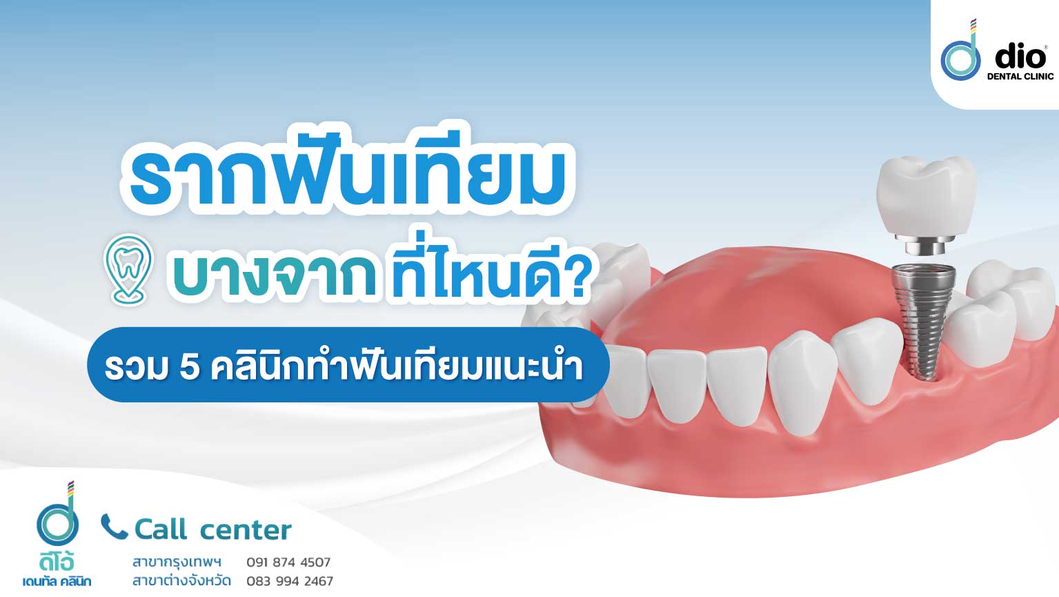รากฟันเทียม บางจาก