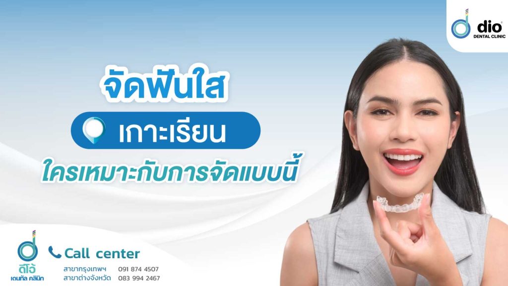 จัดฟันใส เกาะเรียน