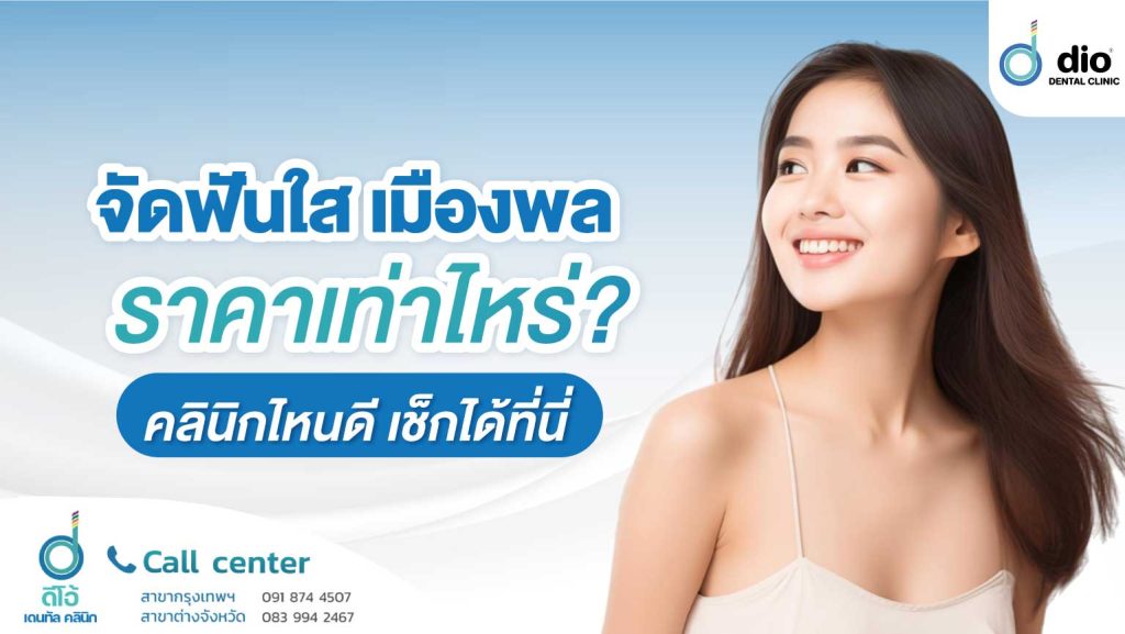 จัดฟันใส เมืองพล