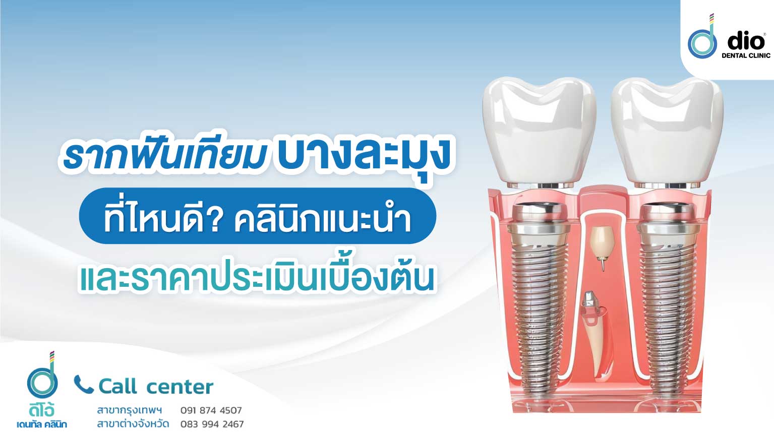 รากฟันเทียม บางละมุง
