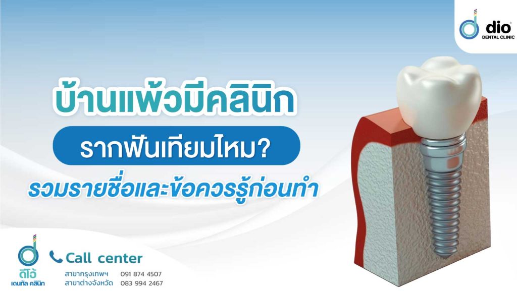 รากฟันเทียม บ้านแพ้ว