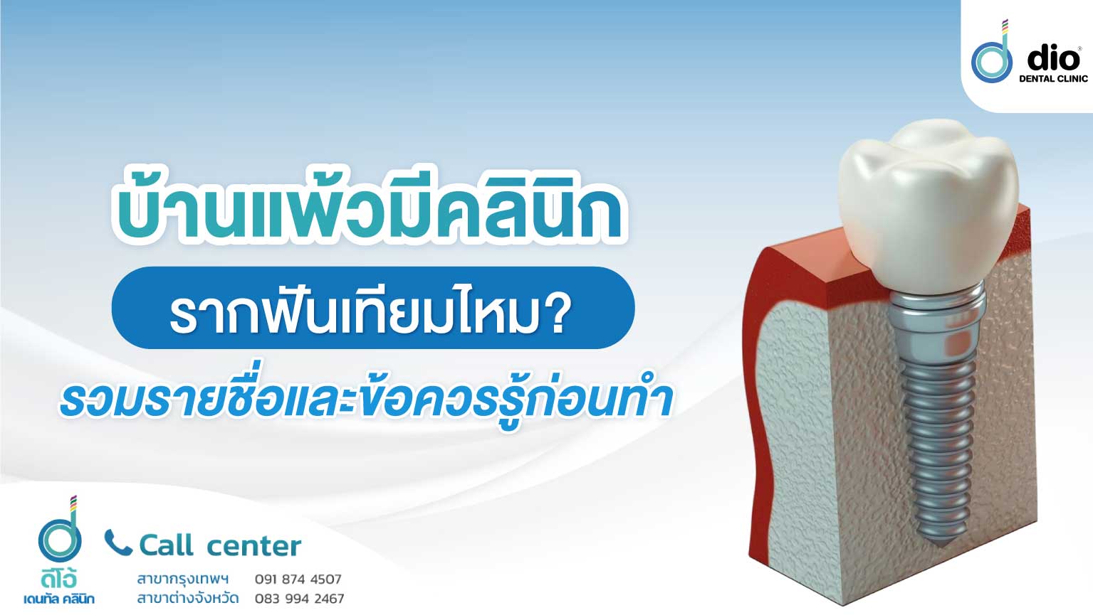 รากฟันเทียม บ้านแพ้ว