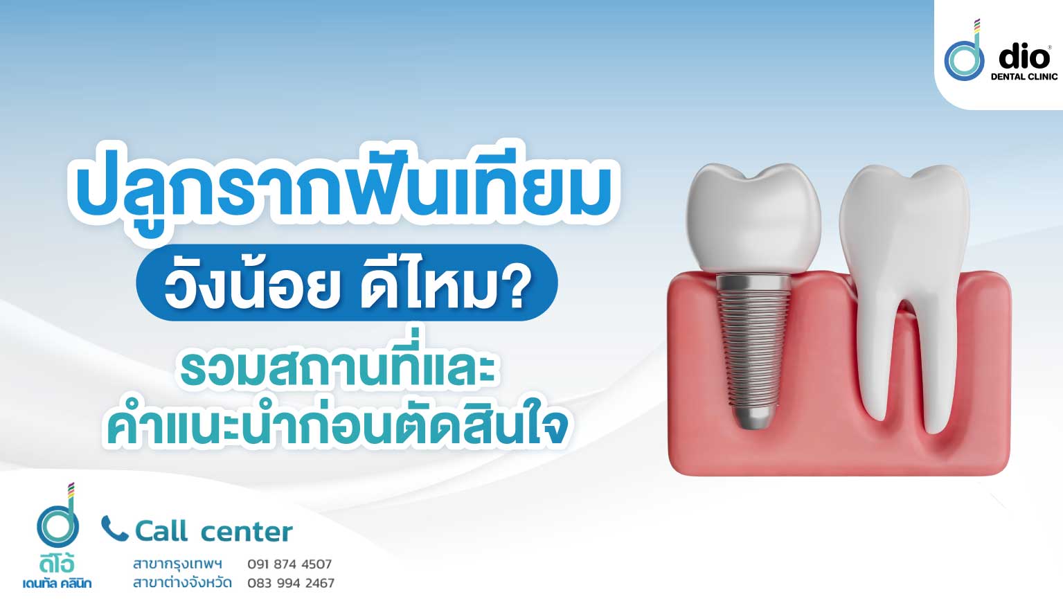 รากฟันเทียม วังน้อย