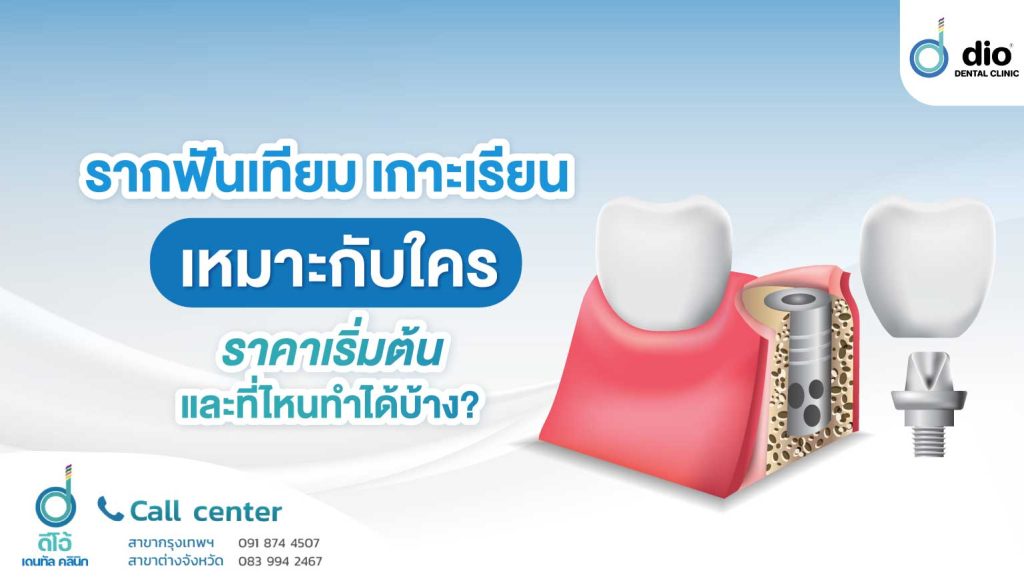 รากฟันเทียม เกาะเรียน