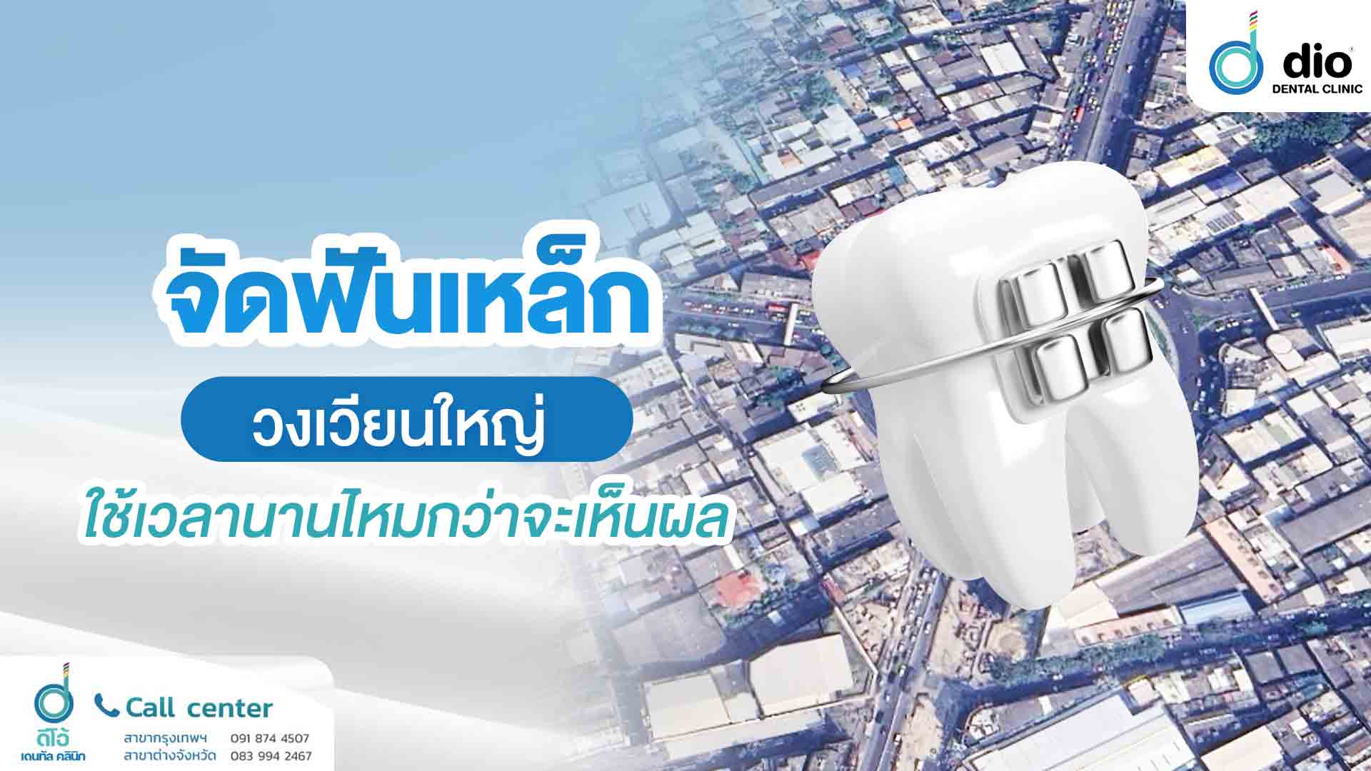 จัดฟันเหล็ก วงเวียนใหญ่