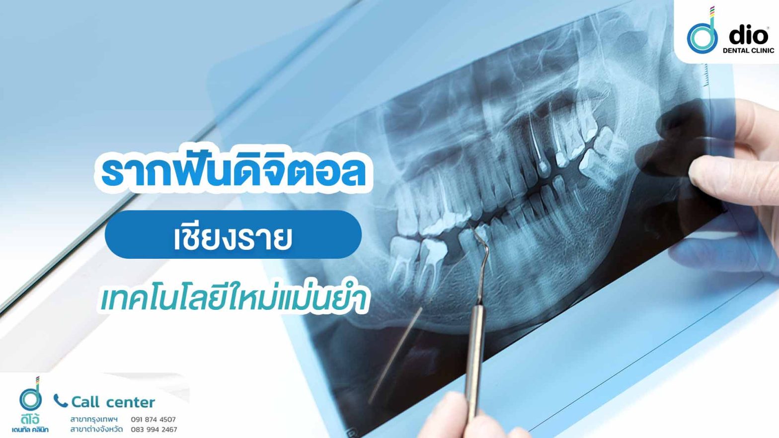 รากฟันดิจิตอล เชียงราย เทคโนโลยีใหม่แม่นยำ