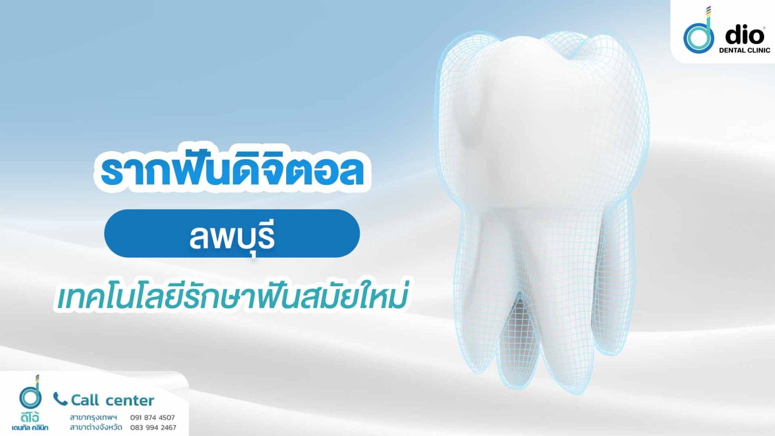 รากฟันเทียมดิจิตอล ลพบุรี