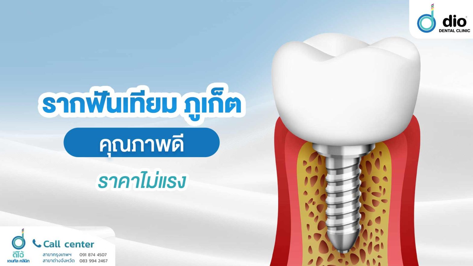 รากฟันเทียม ภูเก็ต
