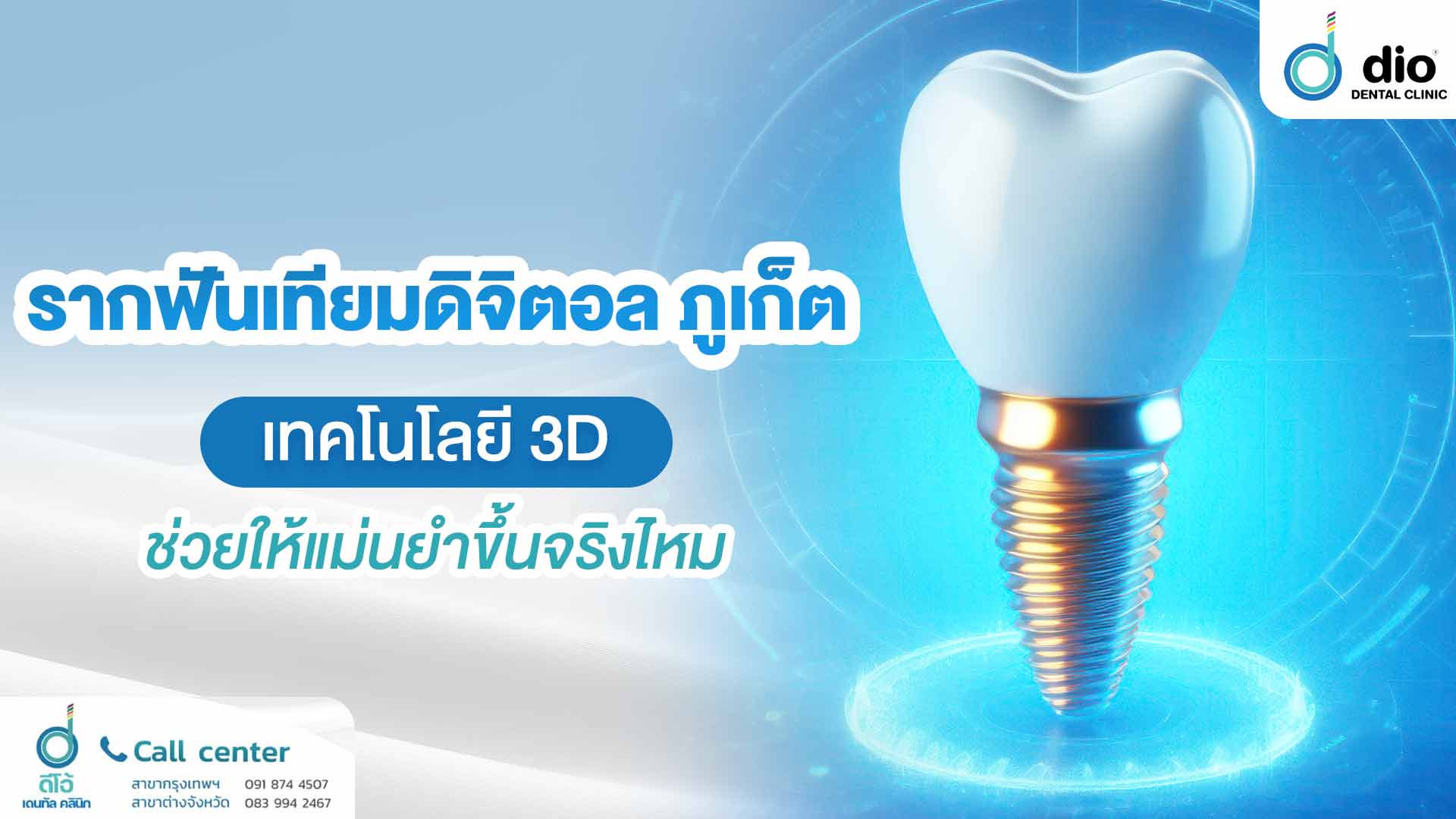 รากฟันเทียมดิจิตอล ภูเก็ต