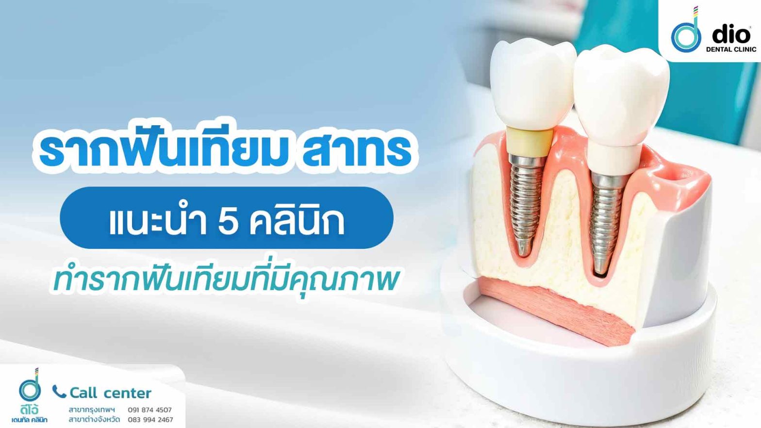 รากฟันเทียม สาทรแนะนำ 5 คลินิกทำรากฟันเทียมที่มีคุณภาพ