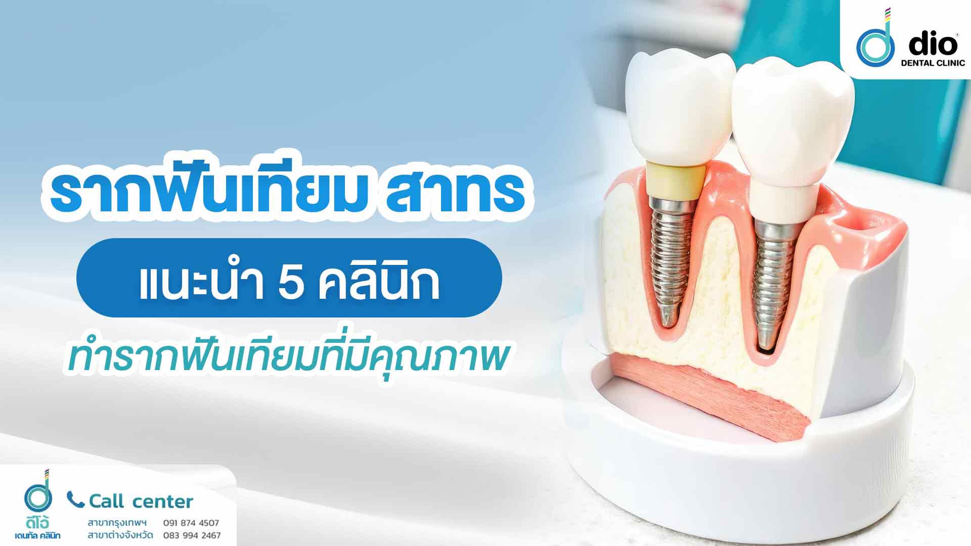 รากฟันเทียม สาทรแนะนำ 5 คลินิกทำรากฟันเทียมที่มีคุณภาพ