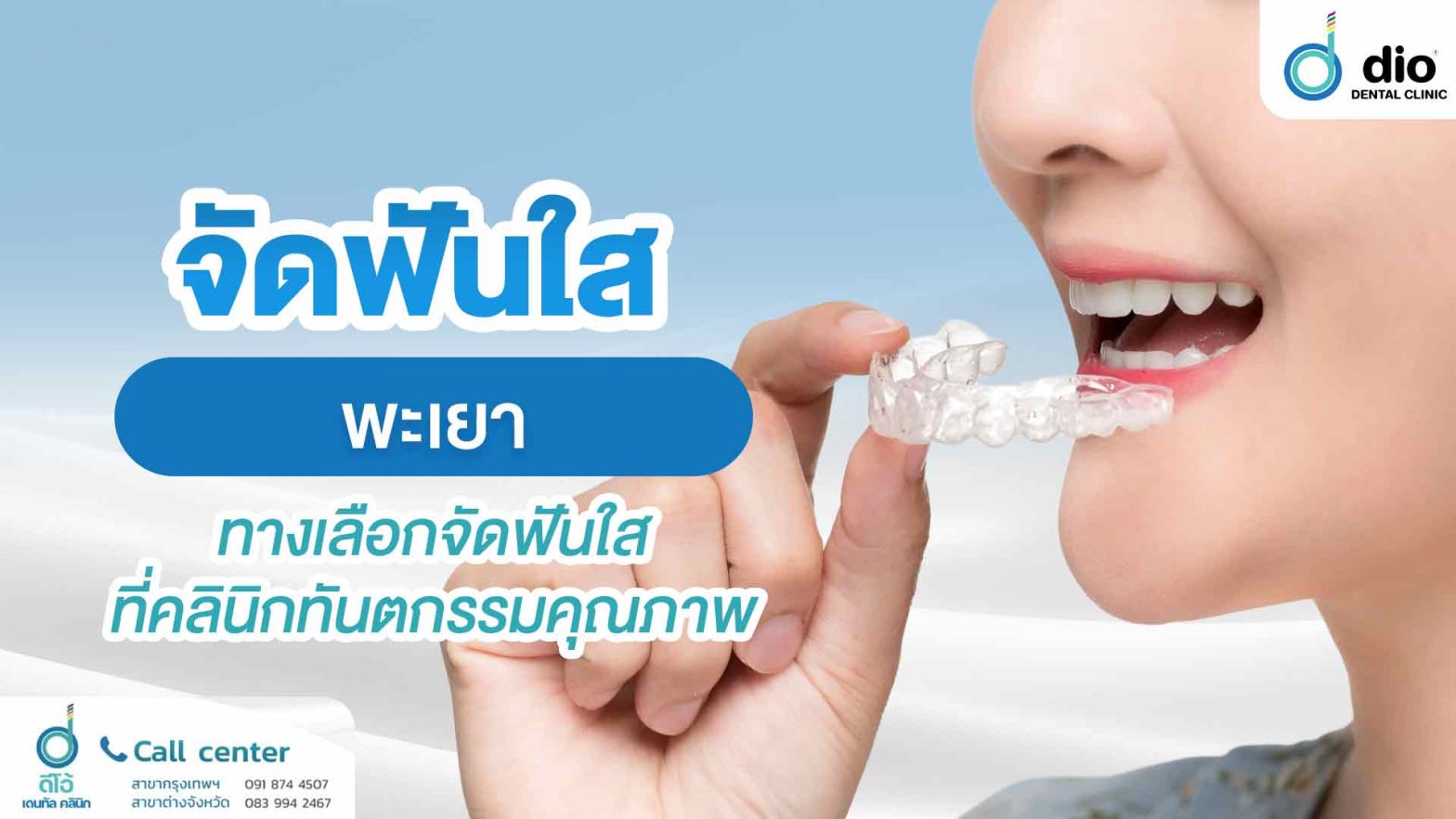 จัดฟันใส-พะเยา-ทางเลือกจัดฟันใสที่คลินิกทันตกรรมคุณภาพ