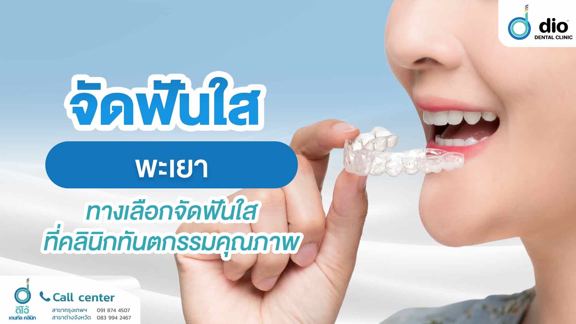 จัดฟันใส-พะเยา-ทางเลือกจัดฟันใสที่คลินิกทันตกรรมคุณภาพ