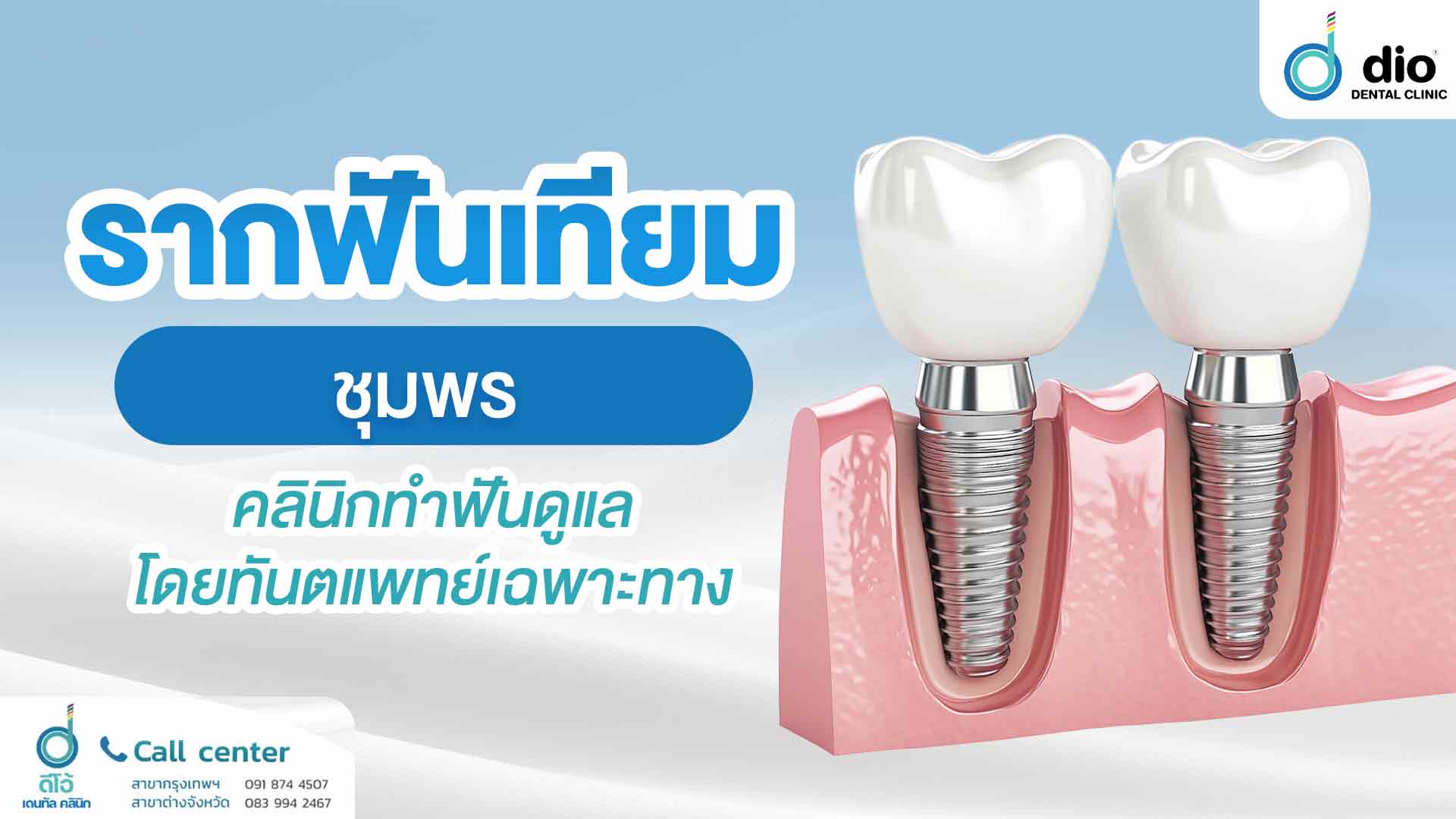 รากฟันเทียม-ชุมพร-คลินิกทำฟันดูแลโดยทันตแพทย์เฉพาะทาง