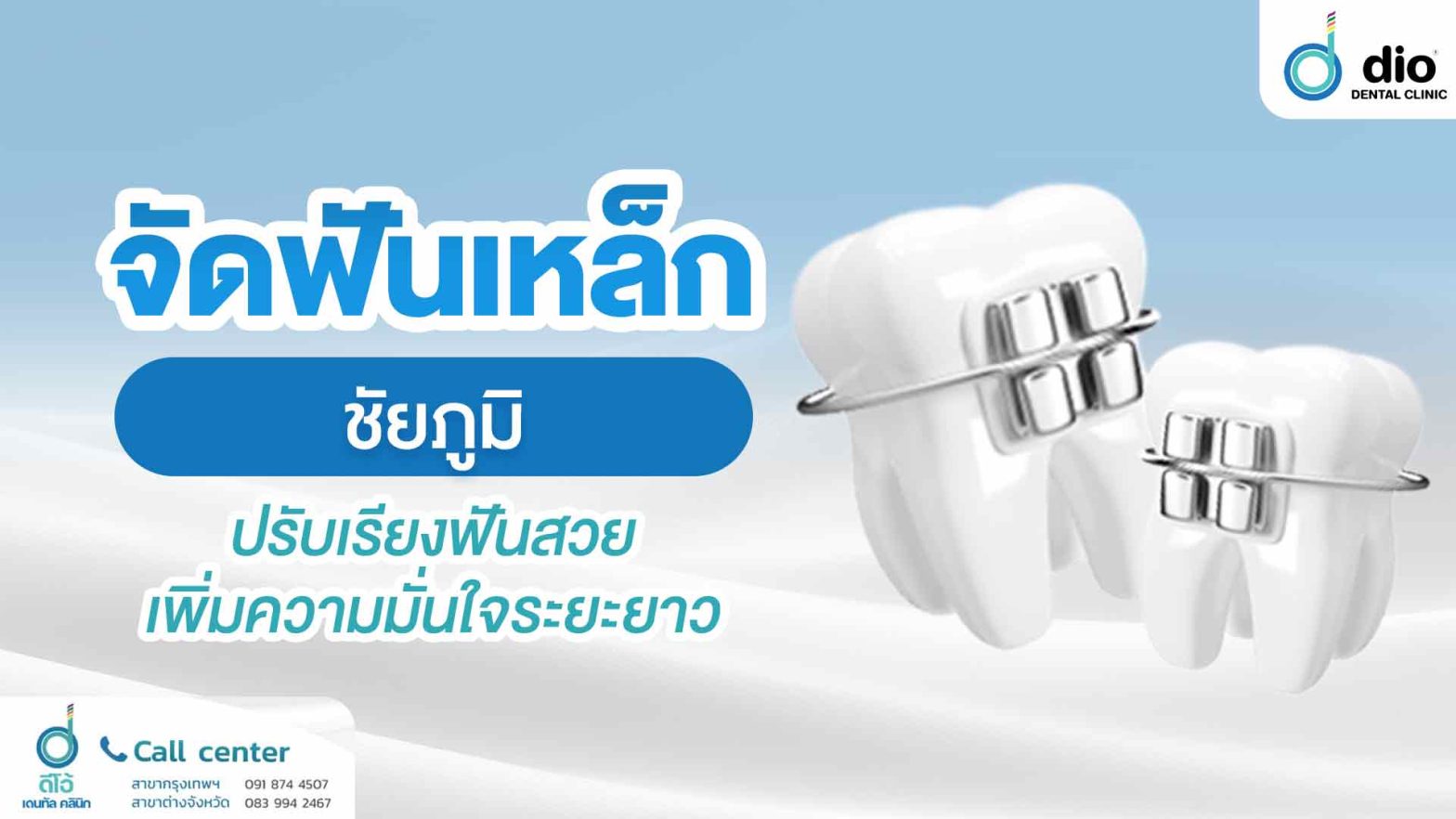 จัดฟันเหล็ก-ชัยภูมิ-ปรับเรียงฟันสวย-เพิ่มความมั่นใจระยะยาว