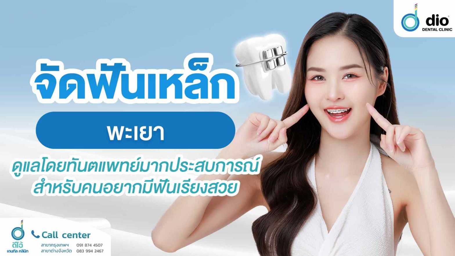 จัดฟันเหล็ก-พะเยา-ดูแลโดยทันตแพทย์มากประสบการณ์-สำหรับคนอยากมีฟันเรียงสวย