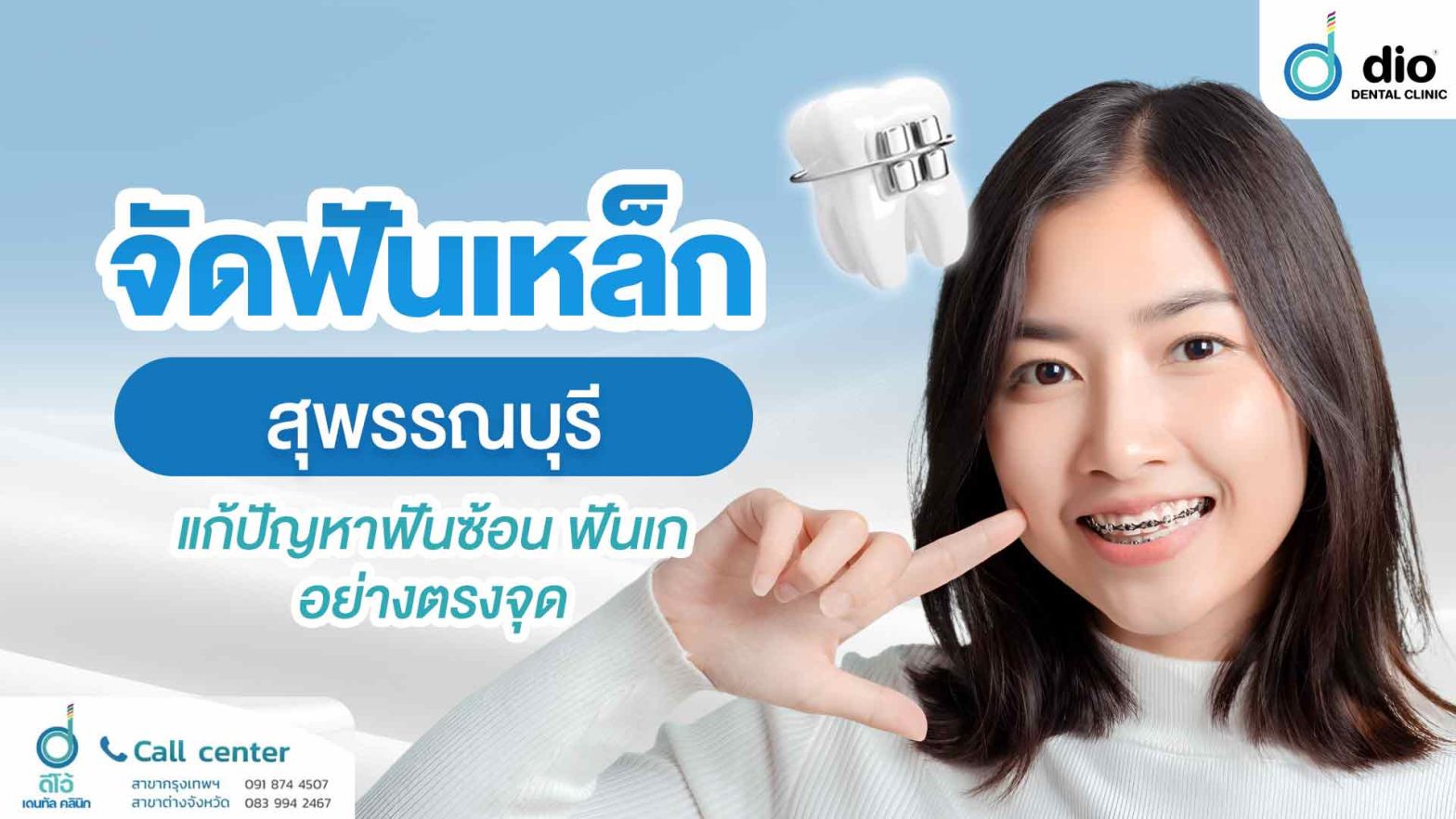 จัดฟันเหล็ก-สุพรรณบุรี-แก้ปัญหาฟันซ้อน-ฟันเก-อย่างตรงจุด