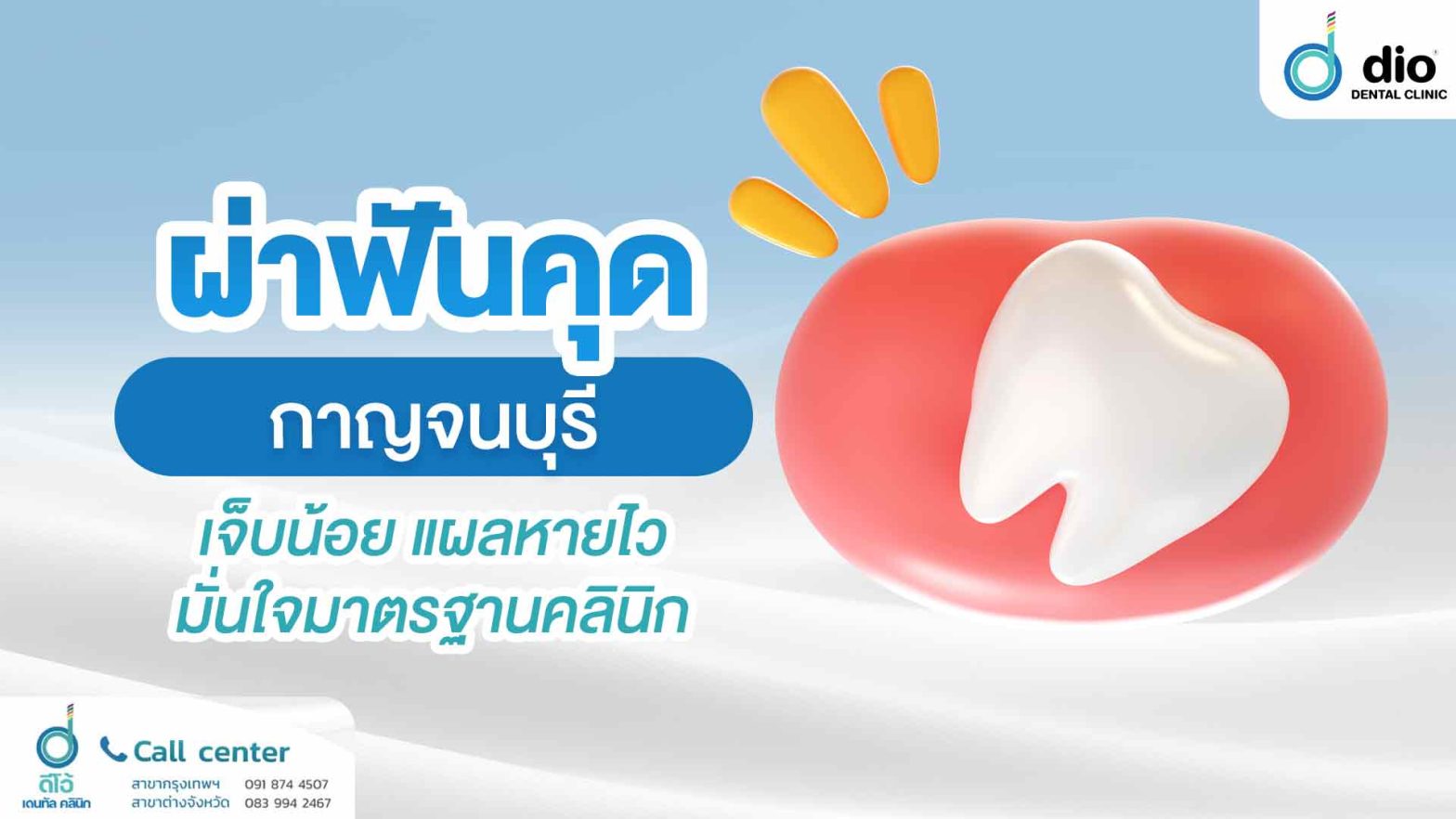 ผ่าฟันคุด-กาญจนบุรี-เจ็บน้อย-แผลหายไว-มั่นใจมาตรฐานคลินิก