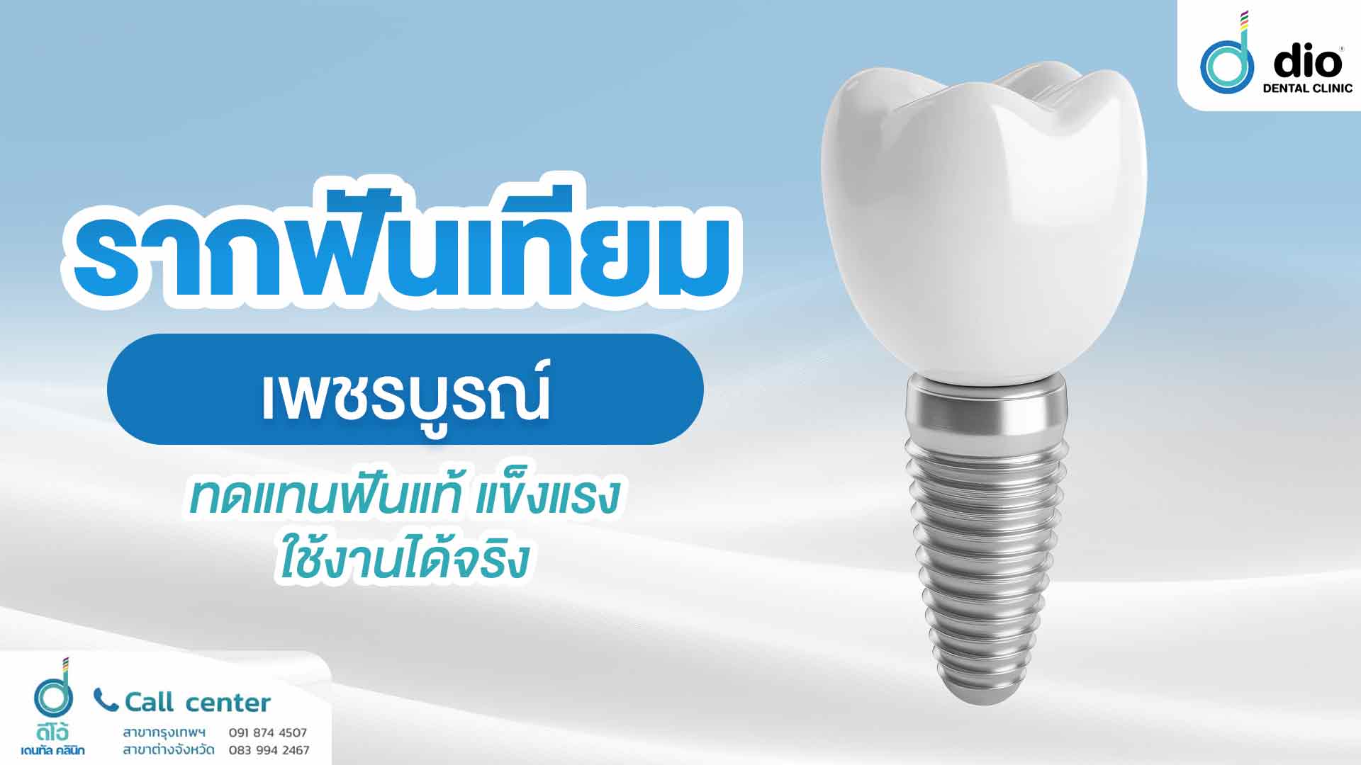 รากฟันเทียม-เพชรบูรณ์-ทดแทนฟันแท้-แข็งแรง-ใช้งานได้จริง