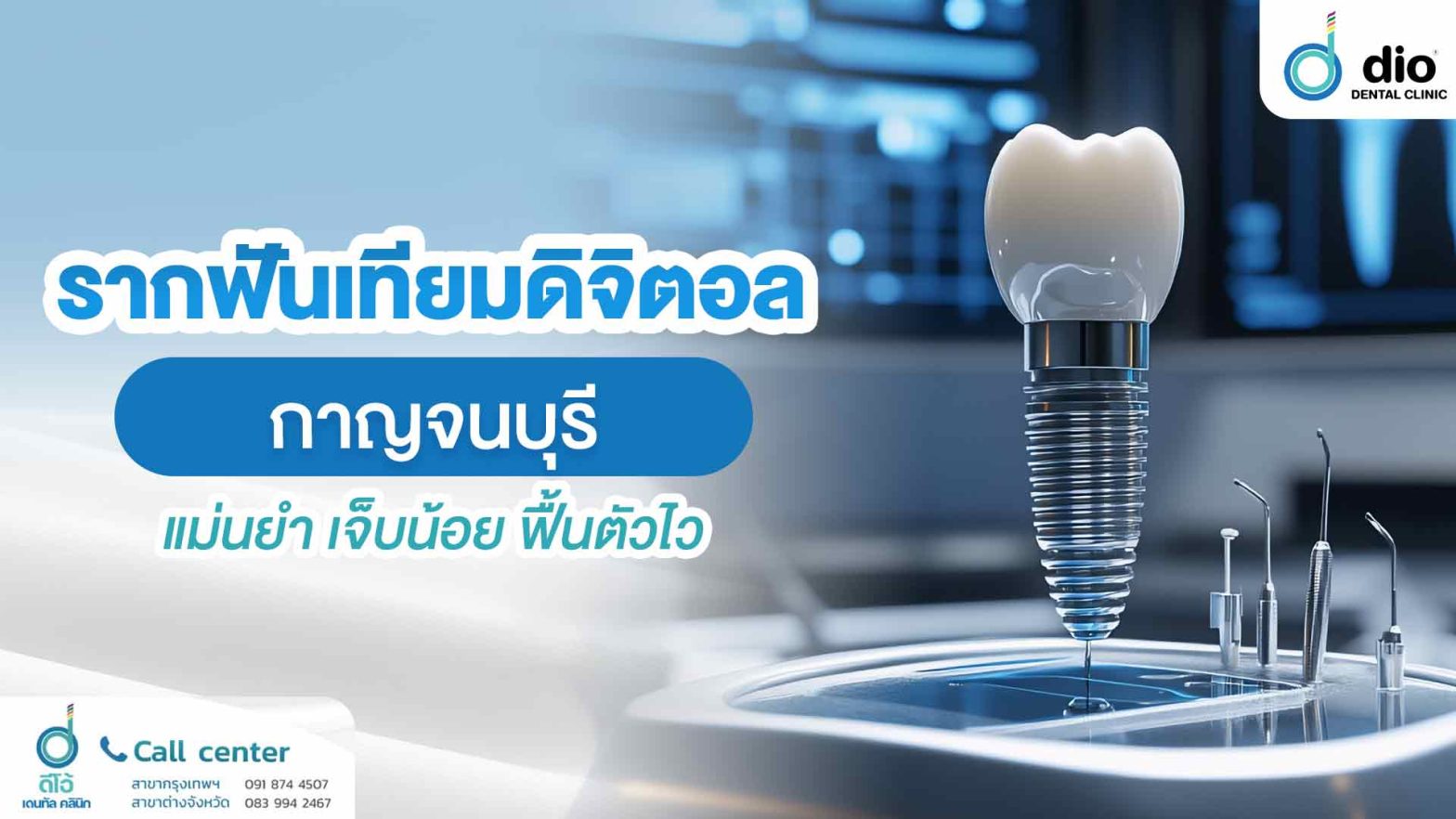 รากฟันเทียมดิจิตอล-กาญจนบุรี-แม่นยำ-เจ็บน้อย-ฟื้นตัวไว