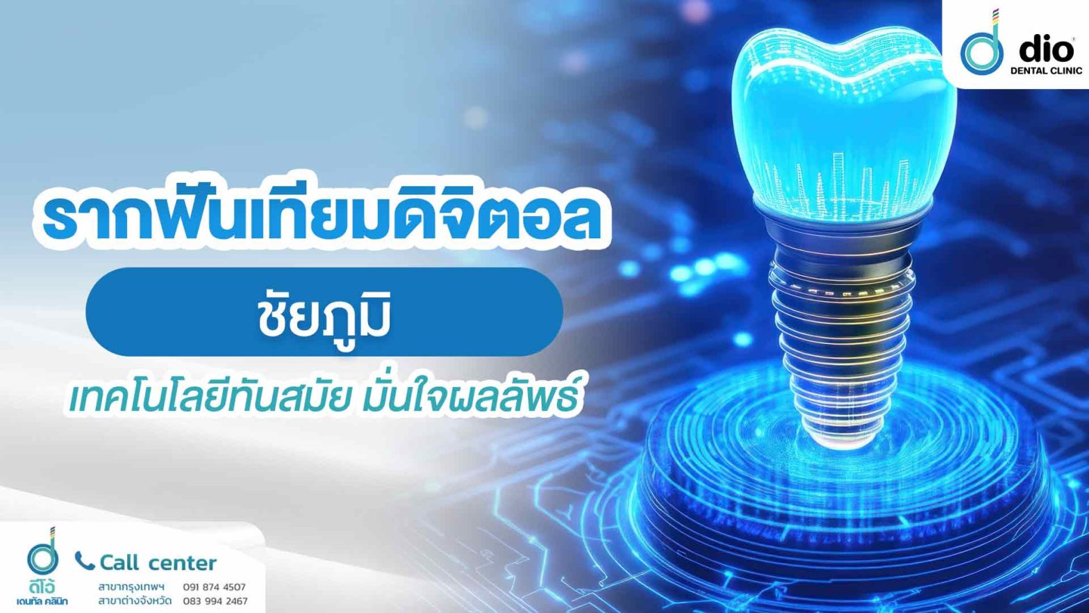 รากฟันเทียมดิจิตอล-ชัยภูมิ-เทคโนโลยีทันสมัย-มั่นใจผลลัพธ์