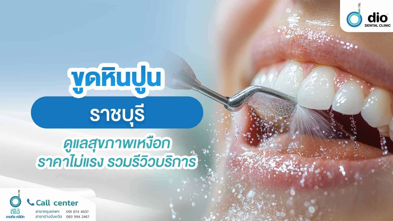 ขูดหินปูน-ราชบุรี-ดูแลสุขภาพเหงือก-ราคาไม่แรง-รวมรีวิวบริการ